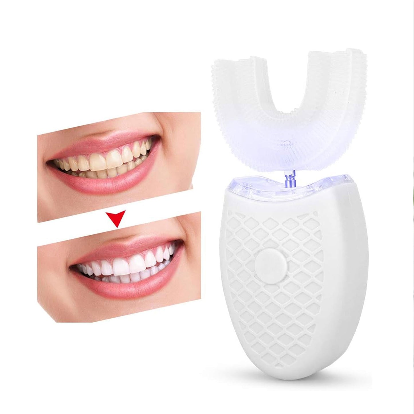 فرشاة الأسنان الأوتوماتيكية